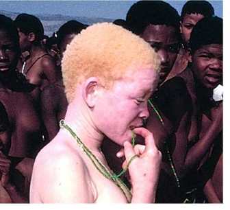 albino10.jpg